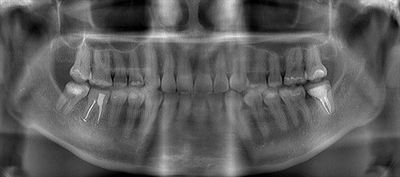 2017.04.05 CT 02_R23.jpg